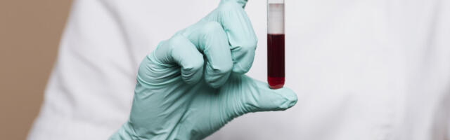 “Crveno-bela krv” 35. put na Marakani