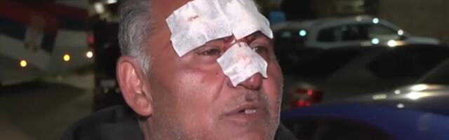 "Oborili su me na zemlju, sav sam u krvi, sve me boli"! Jezivo nasilje blokadera u Knjaževcu: Brutalno pretukli muškarca (VIDEO)