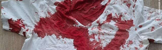 Napad na AFD političara u Rostoku: Levičarski ekstremisti pretukli poslanika ispred kuće