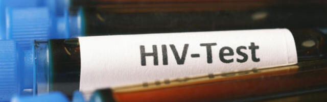 Ново антитело неутралише 98 одсто ХИВ варијанти у лабораторијиским условима