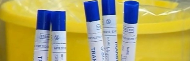 NOVOOBOLELIH I DANAS MANJE NEGO JUČE