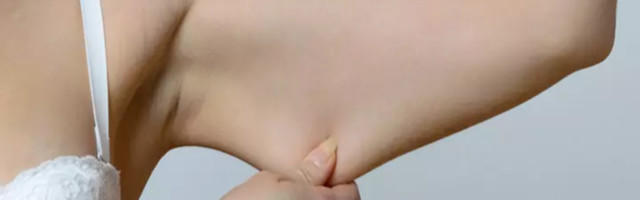 Kako da zategnete kožu nakon gubitka kilograma?