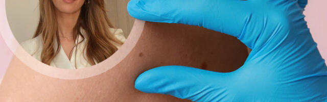 Dr Bojana Novović, dermatovenerolog: Jedna promena na MLADEŽU može biti opasna – proverite da li ste u riziku!