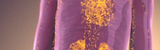 ZA OVU BOLEST SRBI JEDVA DA ZNAJU: Na nju ukazuju trnjenje šaka i vrtoglavica, DO DIJAGNOZE JE PUT DUG 15 GODINA