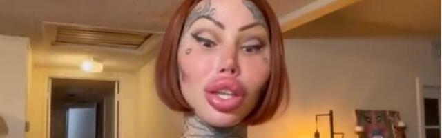 VLASNICA NAJDEBLJE INTIMNE REGIJE I GRUDI NA SVETU SADA IMA PROBLEM: Pogledajte spisak svih operacija koje je uradila, zbog jedne umalo UMRLA