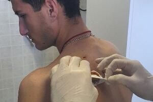 Младић нападнут ножем код Витине на Косову и Метохији