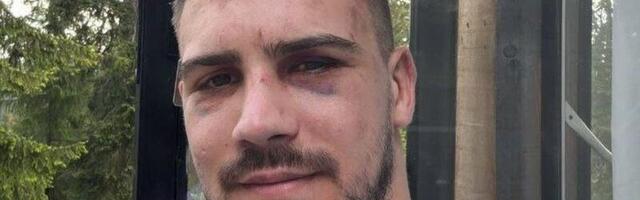 Marko Bojković pokazao lice prvi put nakon meča sa Janičićem i našalio se: "Face ID je radio"