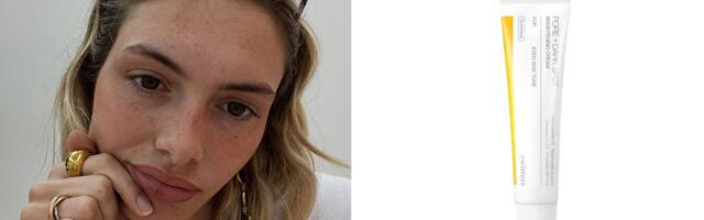 Borite se sa tamnim flekama? Ova K-beauty krema ujednačava ten i daje mu blistav izgled