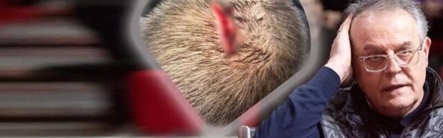 Hrvati su naneli ozbiljne povrede Srbima! Čović otkrio detalje napada (FOTO)