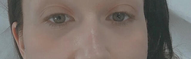 Naša pevačica izvadila silikon iz usana, pa iskreno priznala: "Nisam imala novca i pogrešila sam! Apelujem..."