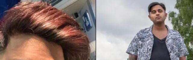 Umesto mikropenisa dobio novi alat koji mu je izrastao na ruci