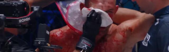 Brutalno! Srbin demolirao Slovenca usred Ljubljane (VIDEO)