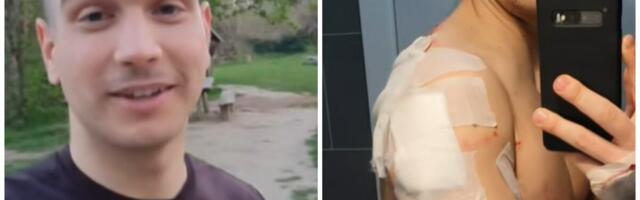 Jeziv napad na Fruškoj gori: Psi bez povoca izujedali triatlonca - Nenad završio u Urgentnom centru