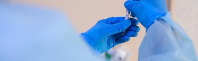 Blagi rast registrovanih slučajeva Korona virusa, "Batut" prati epidemiološke pokazatelje