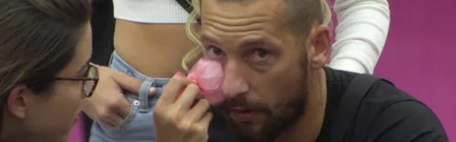 DINO DIZDAREVIĆ ZADOBIO TELESNE POVREDE: Damiro ga iz čista mira GAĐAO FLAŠOM! (FOTO/VIDEO)