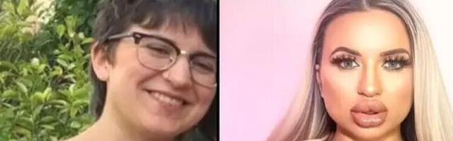 Austrijska "barbika" koje se porodica odrekla zbog plastičnih operacija