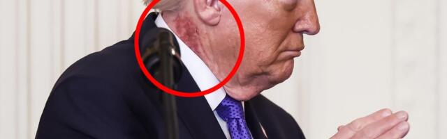 (FOTO) ŠTA JE OVO NA TRAMPOVOM VRATU? U senci sukoba na Bliskom istoku trag na američkom predsedniku podigao sumnje! HITNO SE OGLASILA BELA KUĆA