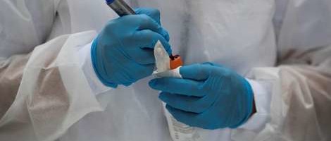 EU finansira nabavku brzih testova za korona virus