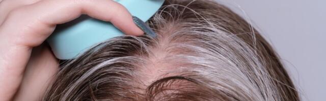 Moćna tajna frizera protiv sede kose je zapravo trik NAŠIH BAKA (VIDEO)