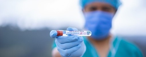 Tri osobe preminule, 757 novozaraženih koronavirusom u Srbiji
