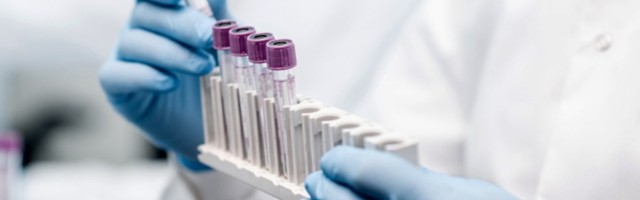 Na KiM 491 novozaraženi, još 12 osoba umrlo