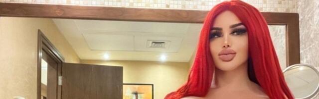 Ljudska Barbi dala 200.000 evra na operacije: Njene ogromne grudi samo što ne eksplodiraju (VIDEO)