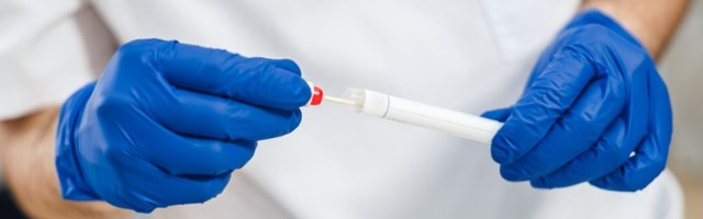 U svetu više od 1,6 miliona ljudi umrlo od kovida