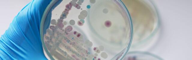 Kupanje u moru pretvorilo se u borbu za život: Opaka bakterija za 3 dana "pojela" muškarcu nogu i umalo ruku