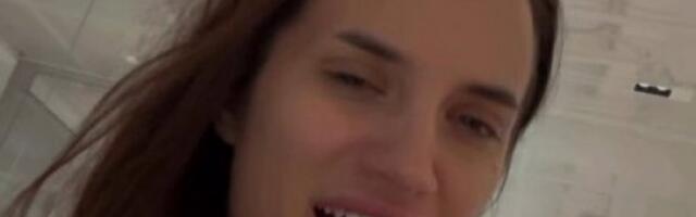 ŠTA SE DESILO BARBARI BOBAK?! Pevačica otkrila ŠOK-STANJE "ZUBI SU MI SE IZLIZALI" (FOTO)