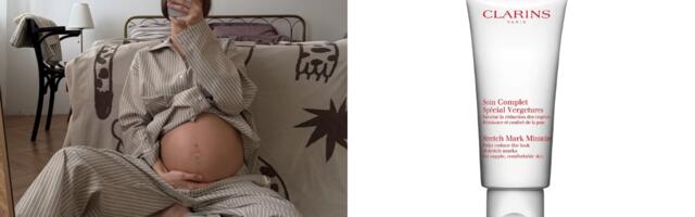 Strije u trudnoći nisu retkost, ali ove kreme mogu pomoći da ih ublažite