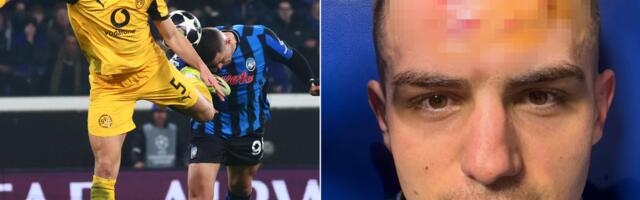 Krstović objavio uznemirujuću sliku iz svlačionice: Alžirac mu pocepao glavu, krvi ima na sve strane /FOTO/