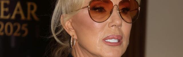 Šta se desilo s Breninim licem, zar je moguće da ovako izgleda: Pevačica objasnila šta se desilo s njenim izgledom (foto)