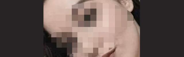 Instruktorka plivanja umrla nakon kupanja u bazenu, njen muž i dečak se bore za život: "Svi napolje, odmah!"