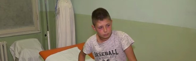 U selu Gojbulja na Kosmetu grupa Albanaca pretukla srpskog dečaka