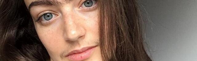 ELDINA JE BOSANSKA LEPOTICA KOJA JE PRESTALA DA SE DEPILIRA! "Ljudi su mi prilazili i govorili da je to KUL!"