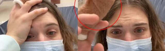 Grickala nokte, pa doživela horor: Umalo ostala bez prsta - šok ispovest zapalila internet (VIDEO)