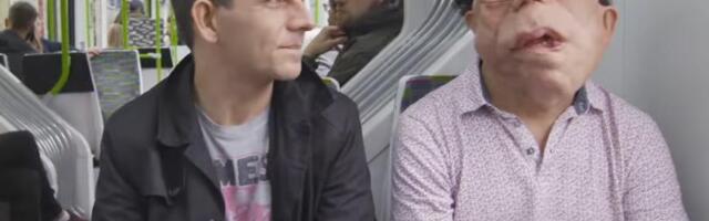 Zbog retke bolesti lice mu je puno tumora, imao je 33 operacije, bio žrtva vršnjačkog nasilja, a onda se proslavio u Holivudu