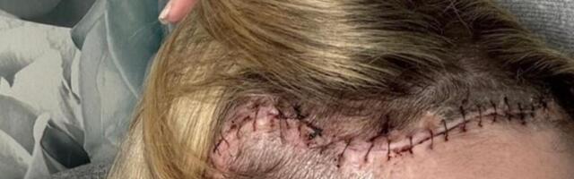 "BIO JE VELIČINE GREJPA": Otišla kod oftamologa, pa je sačekala HOROR VEST! U njoj se krila TEMPIRANA BOMBA