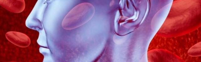 NEUROHIRURG SA VMA OTKRIO ZNAKOVE PUCANJA MOŽDANE ANEURIZME! "Ne daje simptome dok ne pukne, tada čovek..."