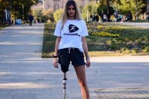 Марији потребна нова протеза, акцију покренуо фудбалер Милош Вуковић који је остао без ноге