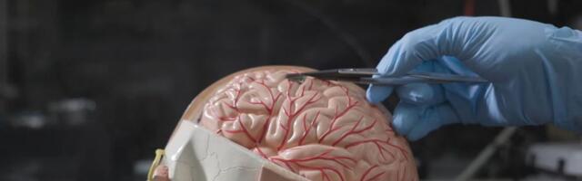 Ponovo može da vidi zahvaljujući implantatu koji stimuliše korteks: Jedan slučaj daje nadu