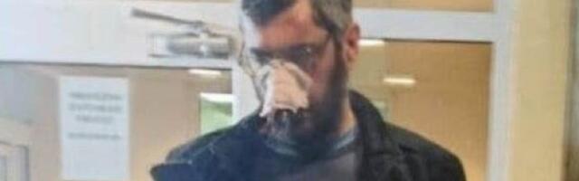 Izbila tuča na sastanku poljoprivrednika u Mrčajevcima, jedan od učesnika završio u bolnici