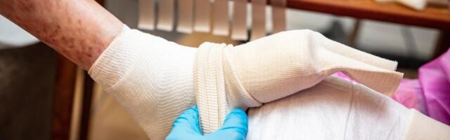 "Ljudi često misle da je u pitanju samo kožno oboljenje, ali ono je veoma kompleksno" Snežana Janošević za Kurir televiziju: "Njima najviše znači naša podrška"