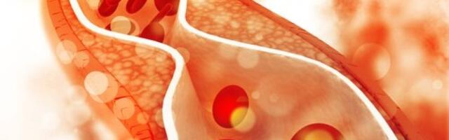 Opasnost na tanjiru: 4 namirnice koje Srbi svakodnevno jedu razaraju arterije