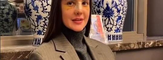 ANĐELA ĐURIČIĆ PROGOVORILA O OPERACIJI NOSA! Rijaliti učesnica otkrila šta se dešavalo u Turskoj: Nisam želela da mi doktor promeni profil