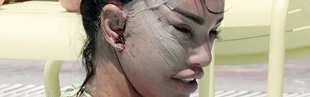 Starleta koja se uništila plastičnim operacijama trudna po šesti put: Udala se za biznismena iz Dubaija, pa javno napala njegovu bivšu ženu