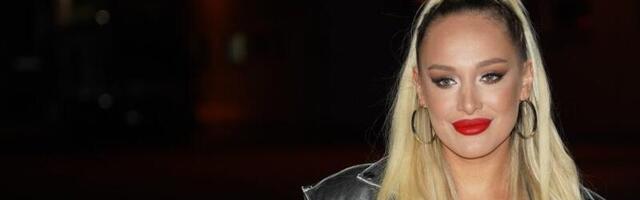 Luna Đogani zadobila ozbiljne opekotine! Ruka joj u ranama, danima trpi bolove (FOTO)