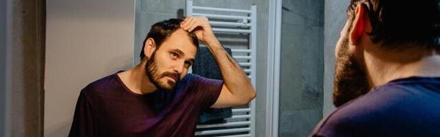 Hirurg objašnjava kako proveriti da li vam se linija kose povlači i da li ćelavite