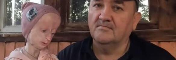 Anja je rođena kao normalna beba, a onda je s 5 dobila dijagnozu: U jednoj godini ostari za 10, a evo kako izgleda njen život