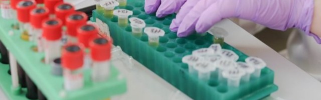 POTVRĐENO, EVROPA U PANICI! Na aerodromu u Nemačkoj PRONAĐEN NOVI SOJ KORONA VIRUSA!